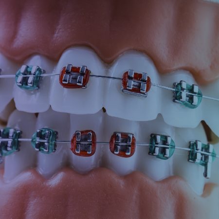 Blogs_The Science of Orthodontics- copia